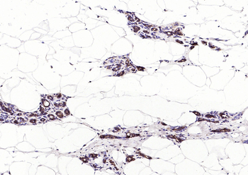 NFKB p65 Recombinant Rabbit Monoclonal Antibody