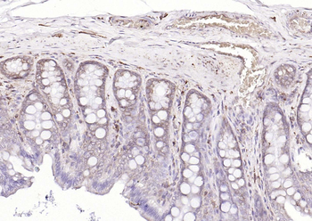 NFKB p65 Recombinant Rabbit Monoclonal Antibody