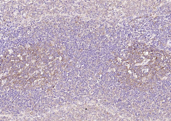 NFKB p65 Recombinant Rabbit Monoclonal Antibody