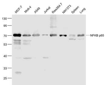 NFKB p65 Recombinant Rabbit Monoclonal Antibody