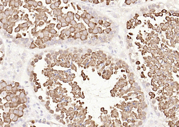 HSP70 Recombinant Rabbit Monoclonal Antibody