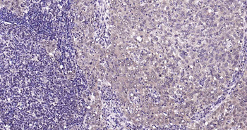 Rad51 Recombinant Rabbit Monoclonal Antibody