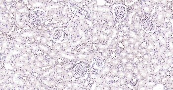 Rad51 Recombinant Rabbit Monoclonal Antibody