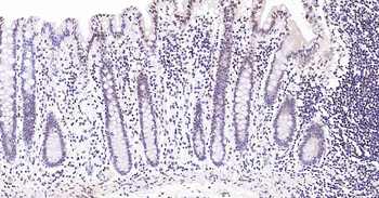 Rad51 Recombinant Rabbit Monoclonal Antibody