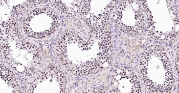 Rad51 Recombinant Rabbit Monoclonal Antibody
