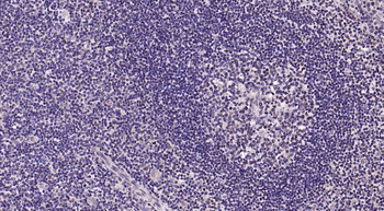 Rad51 Recombinant Rabbit Monoclonal Antibody