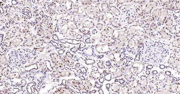 Rad51 Recombinant Rabbit Monoclonal Antibody