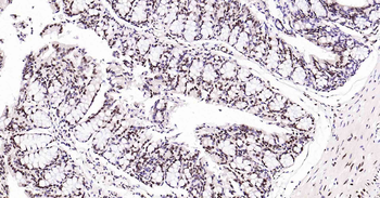 Rad51 Recombinant Rabbit Monoclonal Antibody