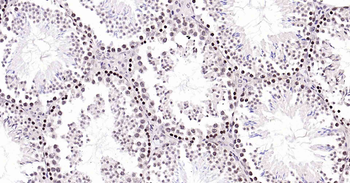 Rad51 Recombinant Rabbit Monoclonal Antibody