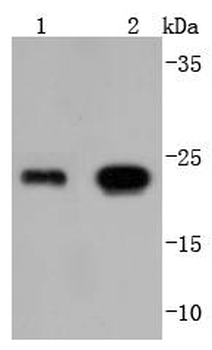 GPX1 Recombinant Rabbit Monoclonal Antibody