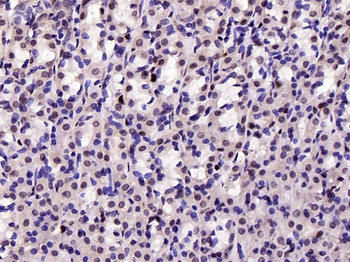 KLF4 Recombinant Rabbit Monoclonal Antibody