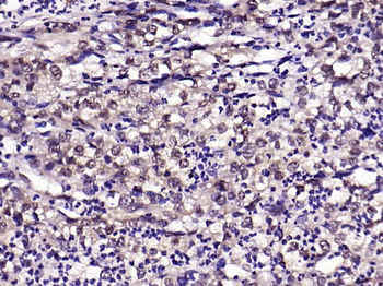 KLF4 Recombinant Rabbit Monoclonal Antibody