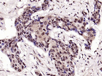 KLF4 Recombinant Rabbit Monoclonal Antibody