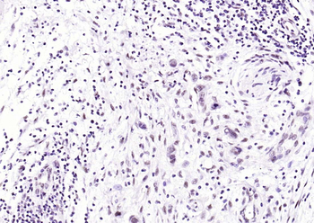 KLF4 Recombinant Rabbit Monoclonal Antibody