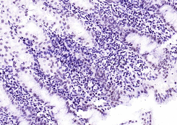 KLF4 Recombinant Rabbit Monoclonal Antibody