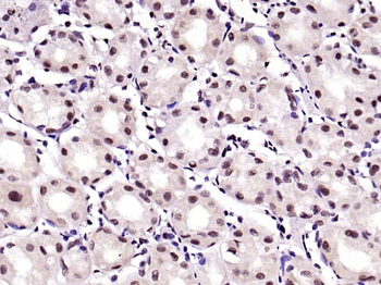 KLF4 Recombinant Rabbit Monoclonal Antibody