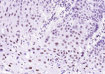 KLF4 Recombinant Rabbit Monoclonal Antibody