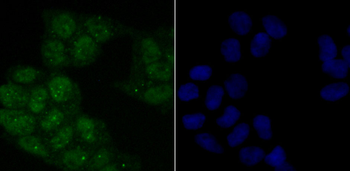 Phospho-ATM (Ser1981) Recombinant Rabbit Monoclonal Antibody