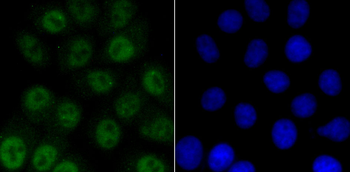 Phospho-ATM (Ser1981) Recombinant Rabbit Monoclonal Antibody