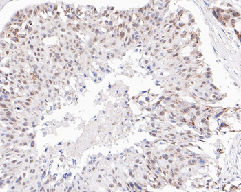 Phospho-ATM (Ser1981) Recombinant Rabbit Monoclonal Antibody