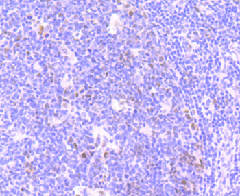 Phospho-ATM (Ser1981) Recombinant Rabbit Monoclonal Antibody