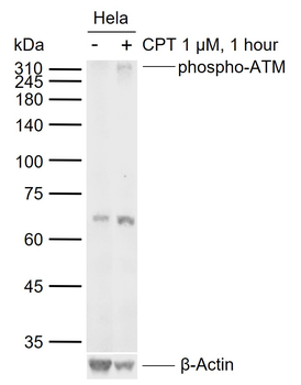 Phospho-ATM (Ser1981) Recombinant Rabbit Monoclonal Antibody