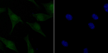 Phospho-ATM (Ser1981) Recombinant Rabbit Monoclonal Antibody