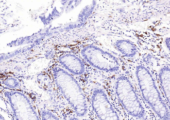HLA-DQA1 Recombinant Rabbit Monoclonal Antibody