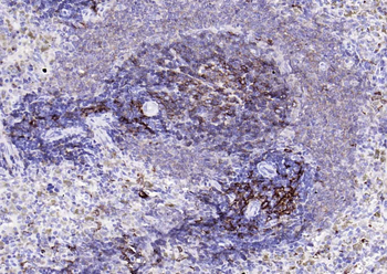 HLA-DQA1 Recombinant Rabbit Monoclonal Antibody