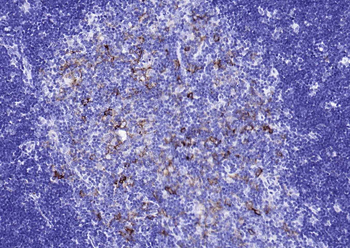 HLA-DQA1 Recombinant Rabbit Monoclonal Antibody