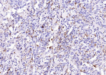 HLA-DQA1 Recombinant Rabbit Monoclonal Antibody