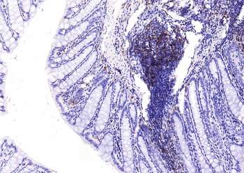 HLA-DQA1 Recombinant Rabbit Monoclonal Antibody