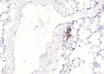 HLA-DQA1 Recombinant Rabbit Monoclonal Antibody