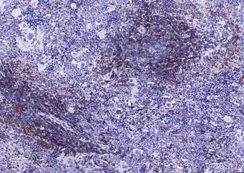 HLA-DQA1 Recombinant Rabbit Monoclonal Antibody