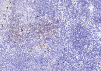 HLA-DQA1 Recombinant Rabbit Monoclonal Antibody
