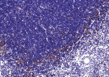 HLA-DQA1 Recombinant Rabbit Monoclonal Antibody