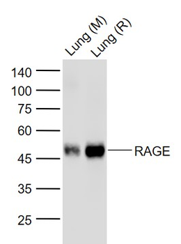 RAGE Recombinant Rabbit Monoclonal Antibody