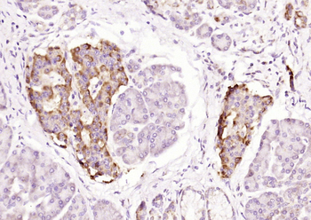 IKK gamma Rabbit Polyclonal Antibody