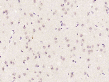 E2F3 Rabbit Polyclonal Antibody