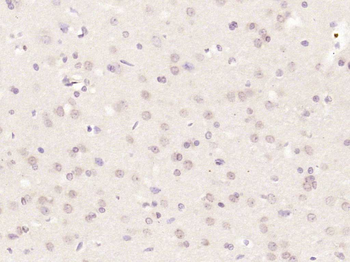 E2F3 Rabbit Polyclonal Antibody