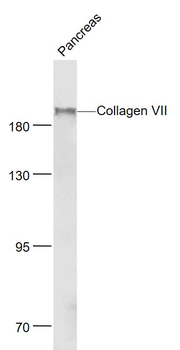 Collagen VII Rabbit Polyclonal Antibody