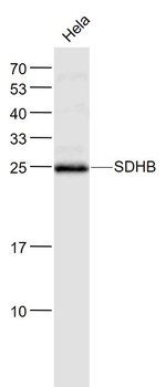 SDHB Rabbit Polyclonal Antibody