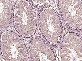 HOXD10 Rabbit Polyclonal Antibody