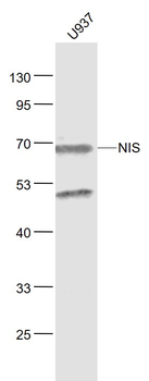 NIS Rabbit Polyclonal Antibody