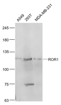 ROR1 Rabbit Polyclonal Antibody