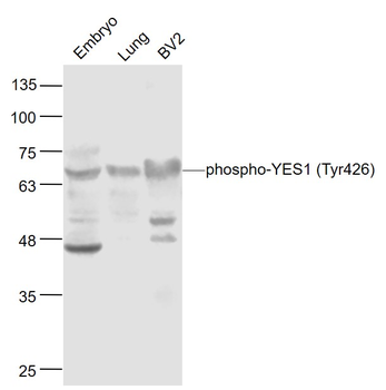Phospho-YES1 (Tyr426) Rabbit Polyclonal Antibody