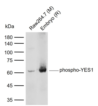Phospho-YES1 (Tyr426) Rabbit Polyclonal Antibody