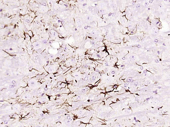 GFAP (ready to use) Mouse Monoclonal Antibody