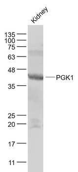 PGK1 Rabbit Polyclonal Antibody