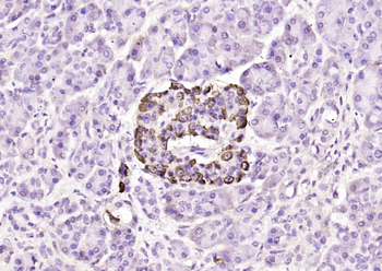 VEGFA Rabbit Polyclonal Antibody